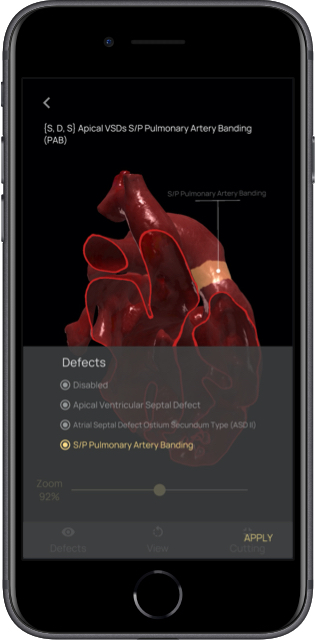 App mobile per taglio digitale del cuore 3D