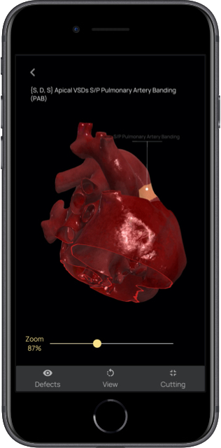 Zoom app modello 3D del cuore